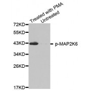 Western blot analysis of extracts from HL60 cells, using phospho-MAP2K6-S207 antibody (abx000440).