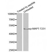 Western blot analysis of extracts from mouse brain tissue using Phospho-MAPT-T231 antibody (abx000448).
