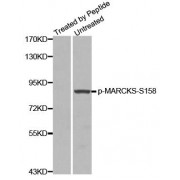 Western blot analysis of extracts from 3T3 cells using Phospho-MARCKS-S158 antibody (abx000449).