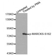 Western blot analysis of extracts from 293 cells, using Phospho-MARCKS-S162 antibody (abx000450).