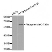 Western blot analysis of extracts from HT29 cells untreated or treated with UV, using phospho-MYC-T358 antibody (abx000458).