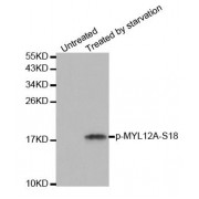 Western blot analysis of extracts from 293 cells untreated or treated with starvation using Phospho-MYL12A-S18 antibody (abx000459).