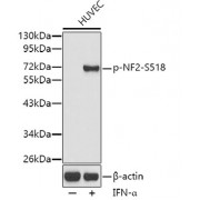 Western blot analysis of extracts from HUVEC cells, using Phospho-NF2-S518 antibody (abx000461).