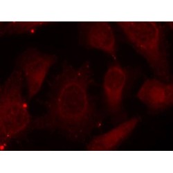Merlin Phospho-Ser518 (NF2 pS518) Antibody