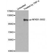 Western blot analysis of extracts from 293 cells untreated or treated with TNF-a using Phospho-NFKB1-S932 antibody (abx000464).