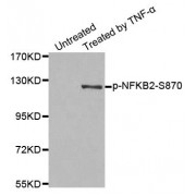 Western blot analysis of extract from MDA-MB-435 cells, using Phospho-NFKB2-S870 antibody (abx000466).