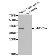 Western blot analysis of extracts of HeLa cell lines, using Phospho-NFKBIA-Y42 antibody (abx000467).