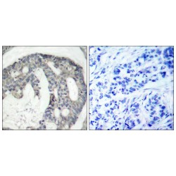 NOS3 (pS1177) Antibody