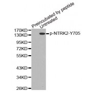 Western blot analysis of extracts from mouse brain tissue, using Phospho-NTRK2-Y705 antibody (abx000470).
