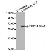 Western blot analysis of extracts from 293 cells, using Phospho-PDPK1-S241 antibody (abx000473).