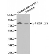 Western blot analysis of extracts from 293 cells, using phospho-PIK3R1/2/3-Y467 antibody (abx000474).