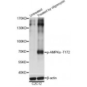 Western blot analysis of extracts of C2C12 cells, using Phospho-PRKAA1-T183/PRKAA2-T172 antibody (abx000479) at 1/2000 dilution. C2C12 cells were treated by Oligomycin (0.5uM) for 30 minutes.