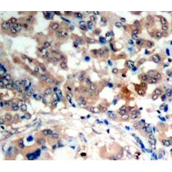 PRKAA1 (pT183 / T172) Antibody