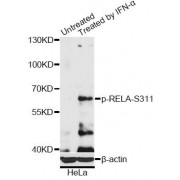 Western blot analysis of extracts of HeLa cells, using Phospho-RELA-S311 antibody (abx000492) at 1/2000 dilution. HeLa cells were treated by IFN-α (100ng/ml) for 30 minutes after serum-starvation overnight.