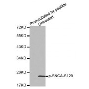 Western blot analysis of extracts from mouse brain tissue, using Phospho-SNCA-S129 antibody (abx000497).