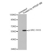 Western blot analysis of extracts from COLO205 cells, using Phospho-SRC-Y418 antibody (abx000499).