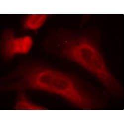 Signal Transducer And Activator of Transcription 1 Phospho-Ser727 (STAT1 pS727) Antibody