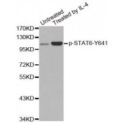 Western blot analysis of extracts from HeLa cells,using Phospho-STAT6-Y641 antibody (abx000503).