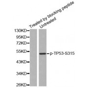 Western blot analysis of extracts from HeLa cells, using Phospho-TP53-S315 antibody (abx000509).