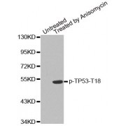 Western blot analysis of extracts from MDA cells, using phospho-TP53-T18 antibody (abx000511).