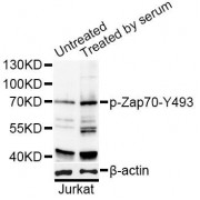 Western blot analysis of extracts of Jurkat cells, using Phospho-ZAP70-Y493 antibody (abx000515) at 1/1000 dilution. Jurkat cells were treated by 10% FBS for 30 minutes after serum-starvation overnight.