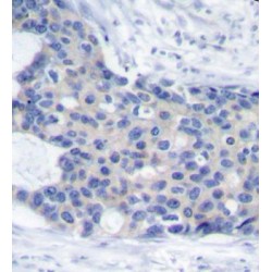 ZAP70 (pY493) Antibody