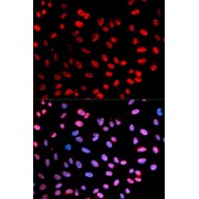 Immunofluorescence analysis of U2OS cells using Phospho-ESPL1-S1126 antibody (abx000516). Blue: DAPI for nuclear staining.