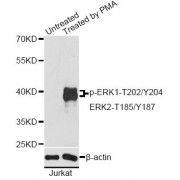 Western blot analysis of extracts of Jurkat cells, using Phospho-ERK1-T202/Y204 + ERK2-T185/Y187 antibody (abx000517) at 1/2000 dilution. Jurkat cells were treated by PMA/TPA (200nM) for 10 minutes.