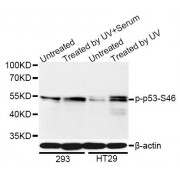 Western blot analysis of extracts of 293 and HT-29 cells, using Phospho-p53-S46 antibody (abx000519) at 1/1000 dilution. 293 cells were treated by UV for 15-30 minutes. HT-29 cells were treated by UV for 15-30 minutes.