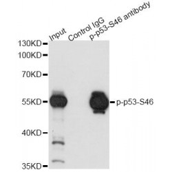 TP53 (pS46) Antibody