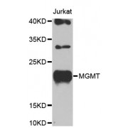 Western blot analysis of extracts of Jurkat cells, using MGMT antibody (abx000535) at 1/1000 dilution.