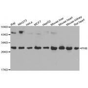 Western blot analysis of extracts of various cell lines, using PHB antibody (abx000537) at 1/1000 dilution.