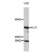 Western blot analysis of extracts of LO2 cells, using FLT1 antibody (abx000538) at 1/1000 dilution.