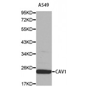 Western blot analysis of extracts of A-549 cells, using CAV1 antibody (abx000539).