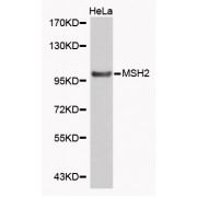 Western blot analysis of extracts of HeLa cells, using MSH2 antibody (abx000543).