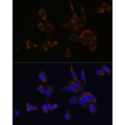Perforin 1 (PRF1) Antibody