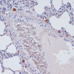 Perforin 1 (PRF1) Antibody