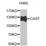 Western blot analysis of extracts of H460 cells, using CAST antibody (abx000552) at 1/1000 dilution.