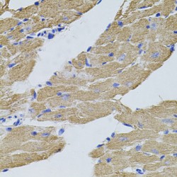 Calpastatin (CAST) Antibody