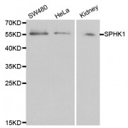 Western blot analysis of extracts of various cell lines, using SPHK1 antibody (abx000568) at 1/1000 dilution.