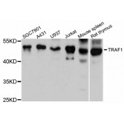 Western blot analysis of extracts of various cell lines, using TRAF1 antibody (abx000575) at 1:3000 dilution.