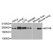 Western blot analysis of extracts of various cell lines, using MYH9 antibody (abx000580) at 1/1000 dilution.