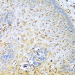 Myosin-9 (MYH9) Antibody