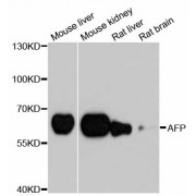 Western blot analysis of extracts of various cell lines, using AFP antibody (abx000589) at 1/1000 dilution.
