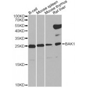 Western blot analysis of extracts of various cell lines, using BAK1 Antibody (abx000593) at 1/1000 dilution.