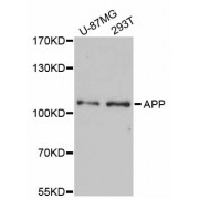 Western blot analysis of extracts of various cell lines, using APP antibody (abx000594) at 1/1000 dilution.