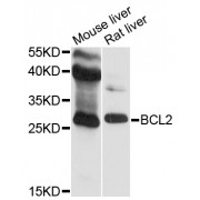 Western blot analysis of extracts of various cell lines, using BCL2 antibody (abx000596) at 1/500 dilution.