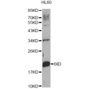 Western blot analysis of extracts of HL-60 cells, using BID Antibody (abx000598).