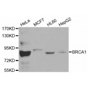 Western blot analysis of extracts of various cell lines, using BRCA1 antibody (abx000600).