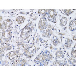 Breast Cancer Type 1 Susceptibility Protein (BRCA1) Antibody